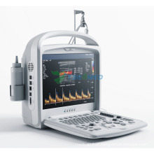 Ultrassom digital portátil colorido Doppler de diagnóstico